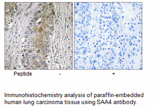 Product image for SAA4 Antibody