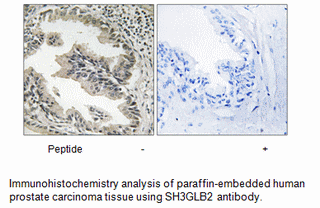 Product image for SH3GLB2 Antibody