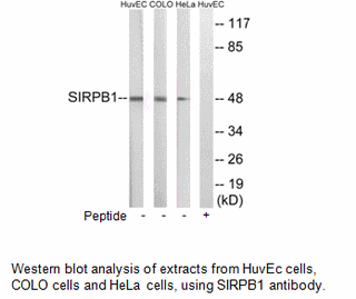 Product image for SIRPB1 Antibody