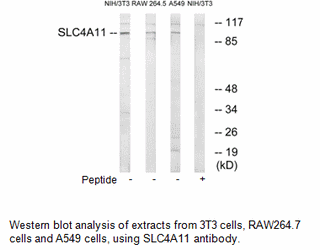 Product image for SLC4A11 Antibody