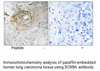 Product image for SCN9A Antibody