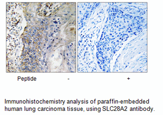 Product image for SLC28A2 Antibody