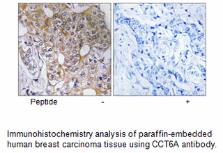 Product image for CCT6A Antibody