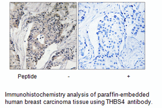 Product image for THBS4 Antibody