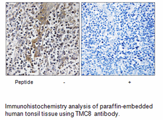 Product image for TMC8 Antibody