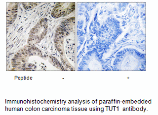 Product image for TUT1 Antibody