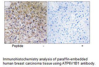 Product image for ATP6V1B1 Antibody