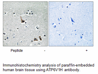 Product image for ATP6V1H Antibody