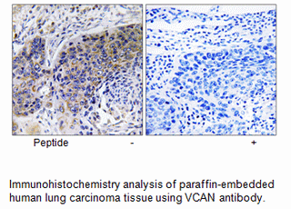 Product image for VCAN Antibody