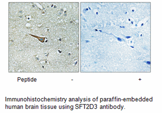 Product image for SFT2D3 Antibody