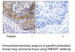 Product image for TMEM37 Antibody