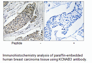 Product image for KCNAB3 Antibody