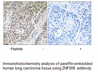 Product image for ZNF608 Antibody