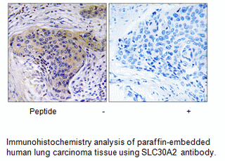 Product image for SLC30A2 Antibody