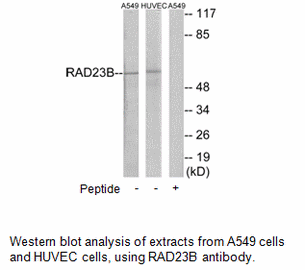 Product image for RAD23B Antibody