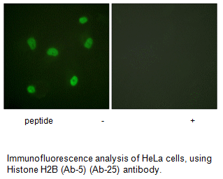 Product image for Histone H2B (Ab-5) Antibody