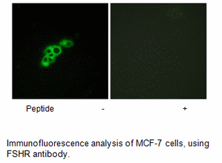 Product image for FSHR Antibody