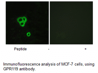 Product image for GPR119 Antibody