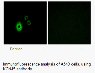 Product image for KCNJ5 Antibody