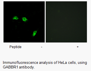 Product image for GABBR1 Antibody