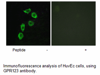 Product image for GPR123 Antibody