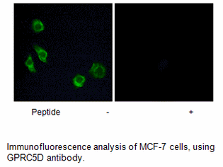 Product image for GPRC5D Antibody