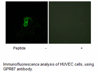 Product image for GPR87 Antibody