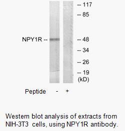 Product image for NPY1R Antibody