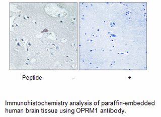 Product image for OPRM1 Antibody