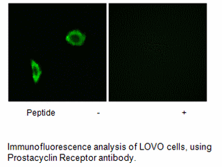 Product image for Prostacyclin Receptor Antibody