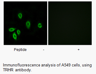 Product image for TRHR Antibody