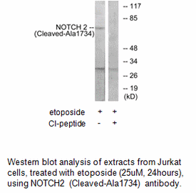 Product image for NOTCH2 (Cleaved-Ala1734) Antibody