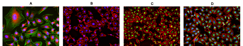 Cells stained with Phalloidin Conjugates