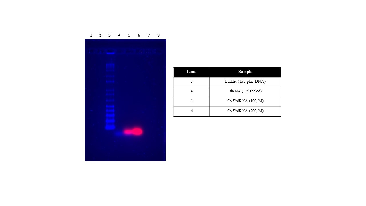 Gel pattern