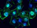 HeLa cell nuclei stained with DAPI