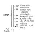 Product image for MEF2A (Ab-408) Antibody