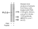 Product image for PLCB3 (Ab-1105) Antibody