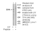 Product image for SYK (Ab-348) Antibody