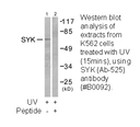 Product image for SYK (Ab-525) Antibody