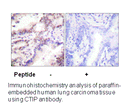 Product image for CTIP (Ab-327) Antibody