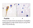 Product image for FAK (Ab-576) Antibody