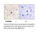 Product image for GR (Ab-226) Antibody