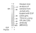 Product image for GR (Ab-226) Antibody