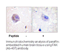 Product image for FAK (Ab-407) Antibody