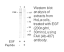 Product image for FAK (Ab-407) Antibody