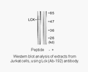 Product image for Lck (Ab-192) Antibody