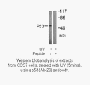 Product image for p53 (Ab-20) Antibody