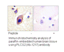 Product image for PLCG2 (Ab-1217) Antibody