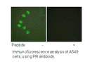 Product image for Progesterone Receptor (Ab-294) Antibody