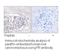 Product image for Progesterone Receptor (Ab-294) Antibody